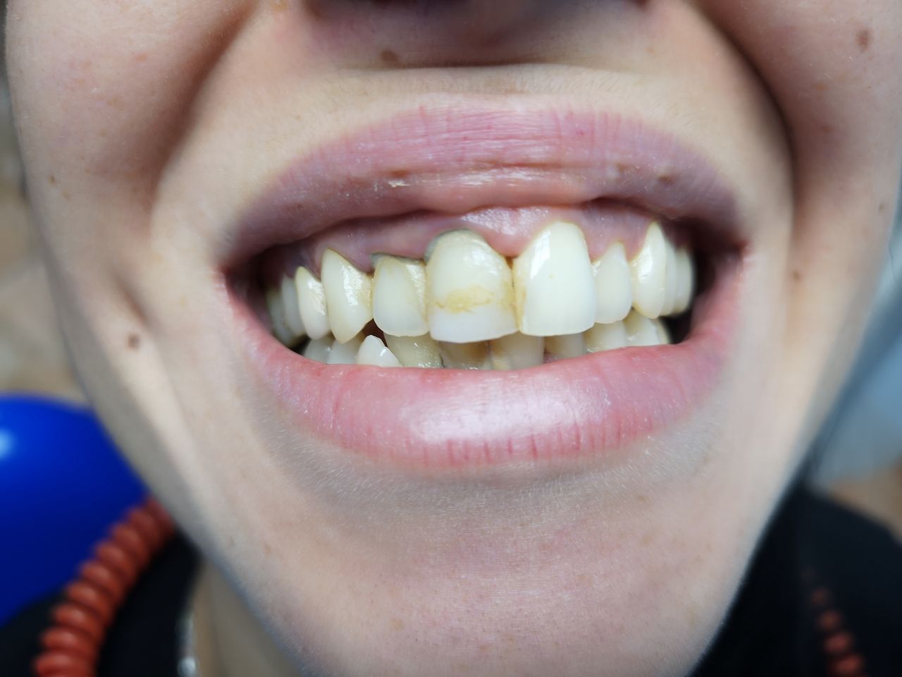 Stefano De Simone-66