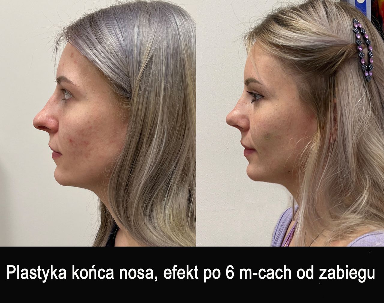 Mariusz Zagajewski-36