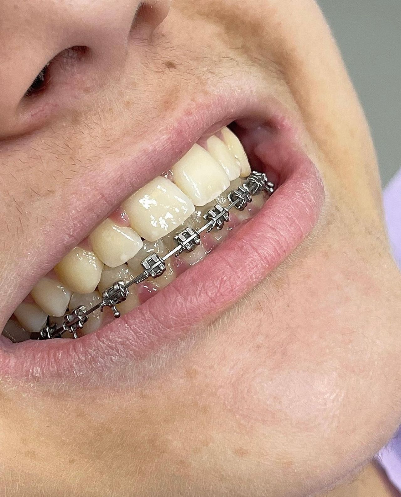 Francesco Sorrentino-4