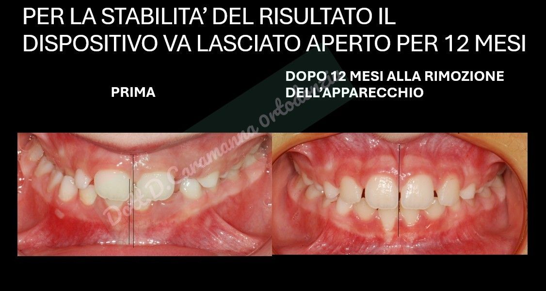 Daniele Caramanna-25