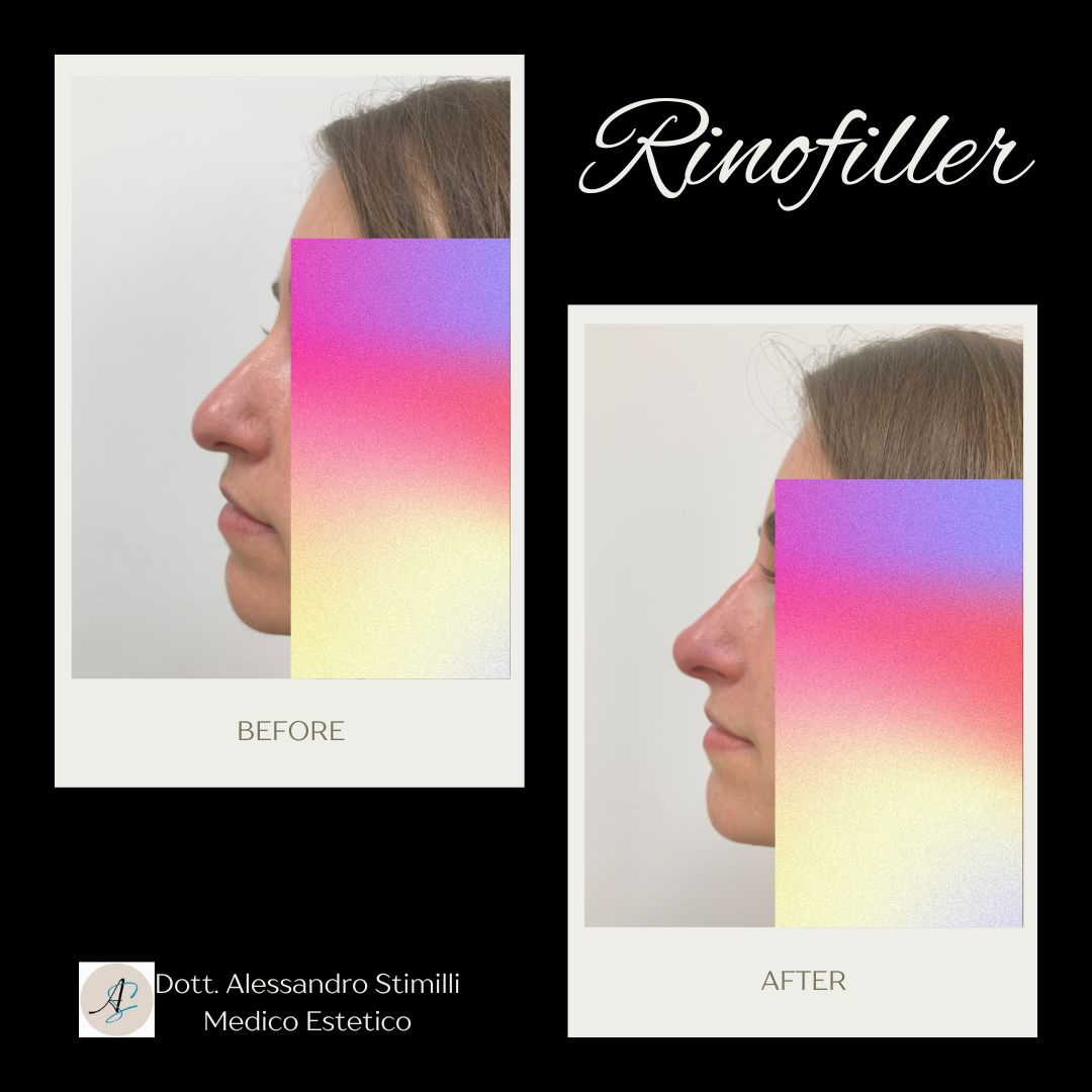 Alessandro Stimilli-12