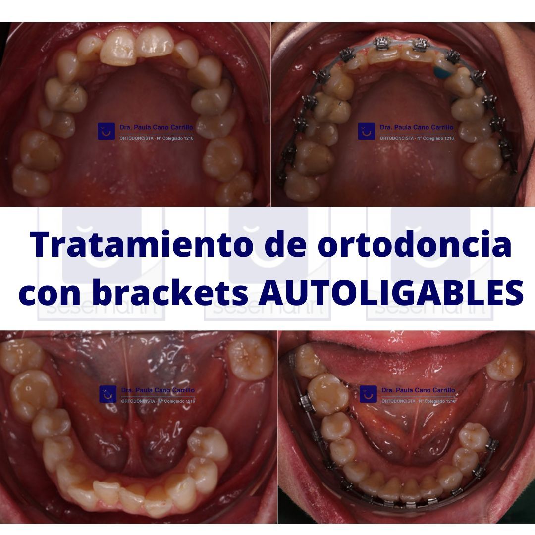 Paula Cano Carrillo-100