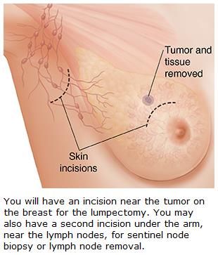Massimiliano D'aiuto-8