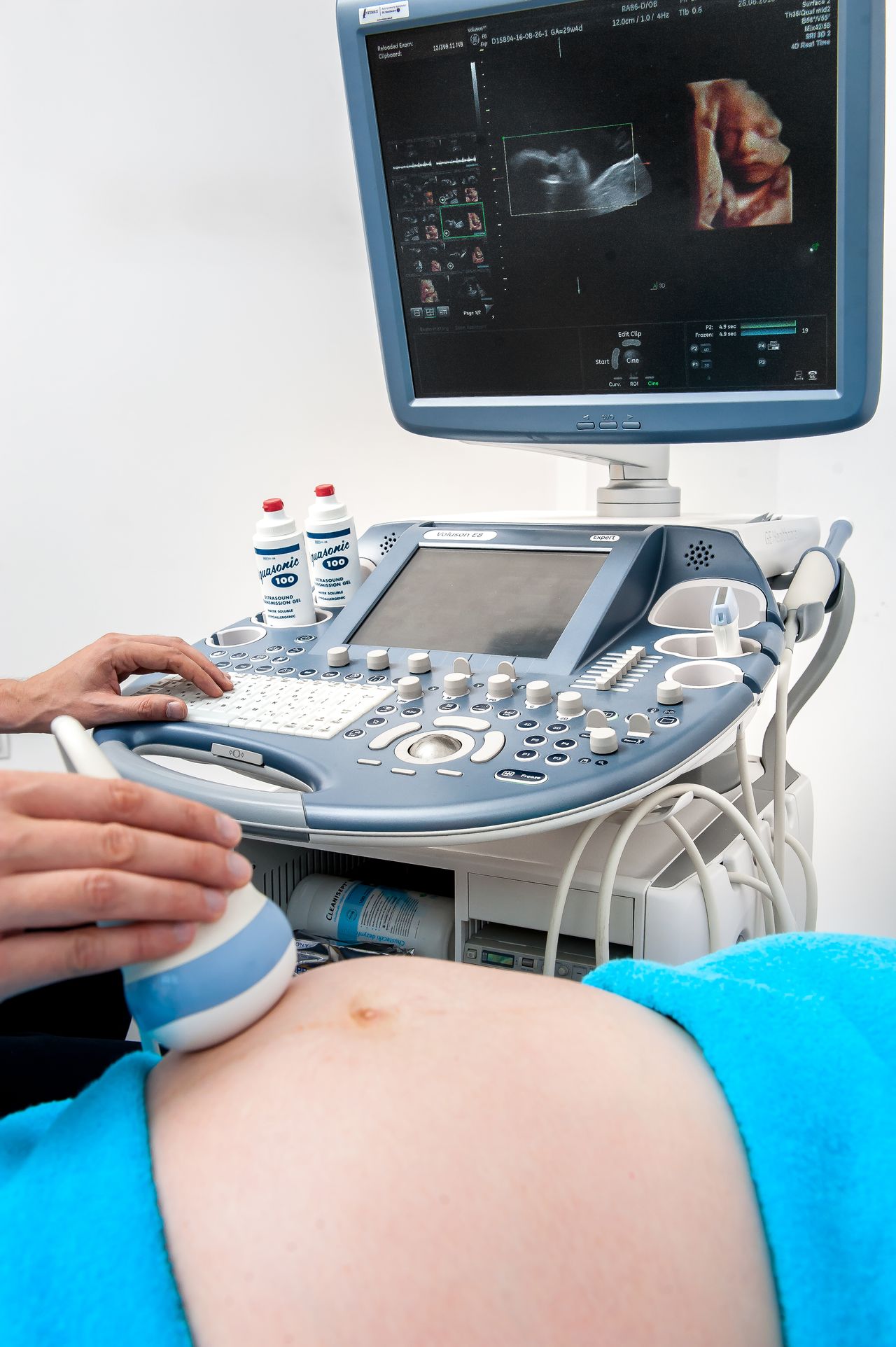 Ewelina Mielczarek-8