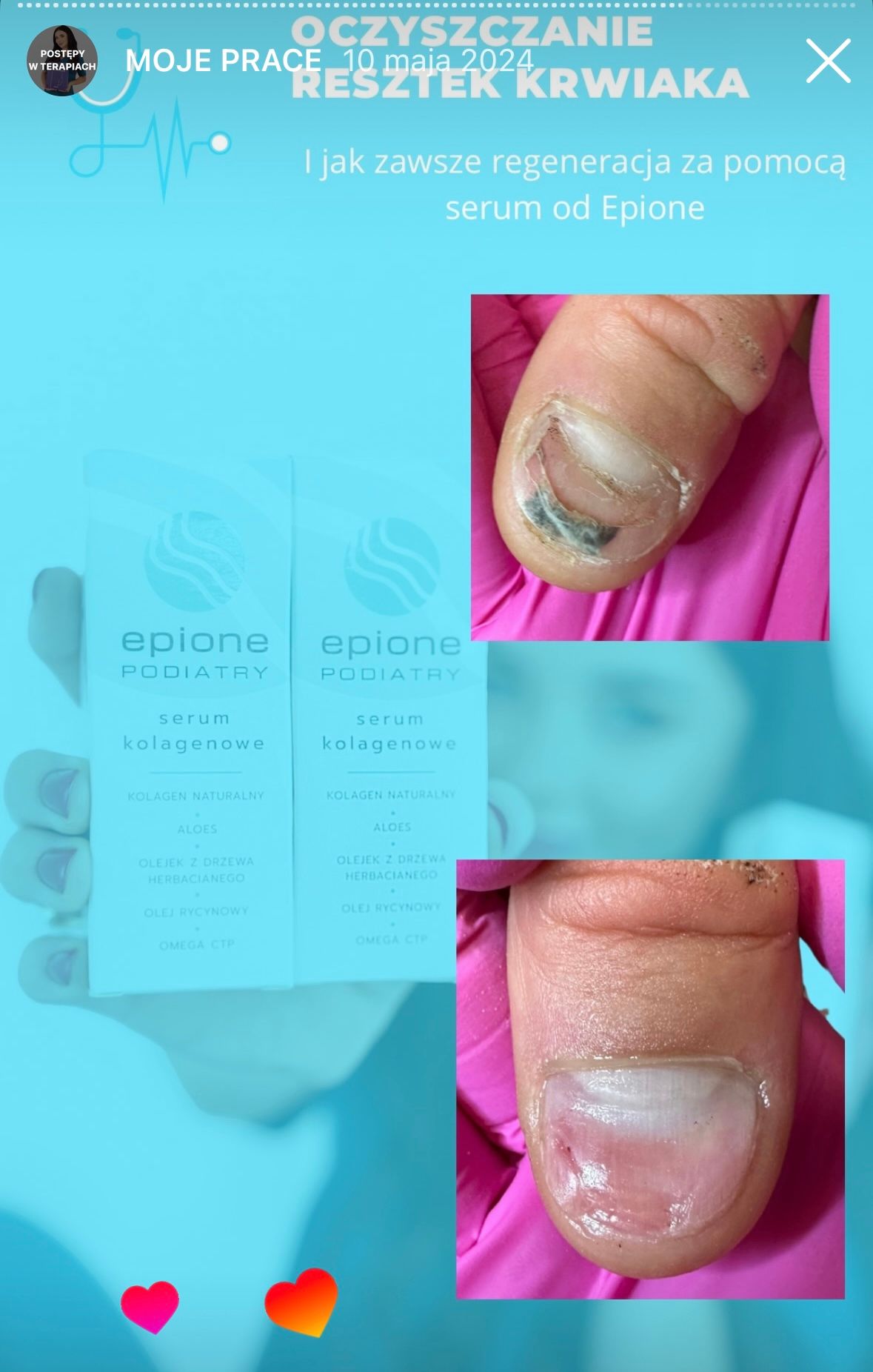 Karolina Colonna-Walewska-12