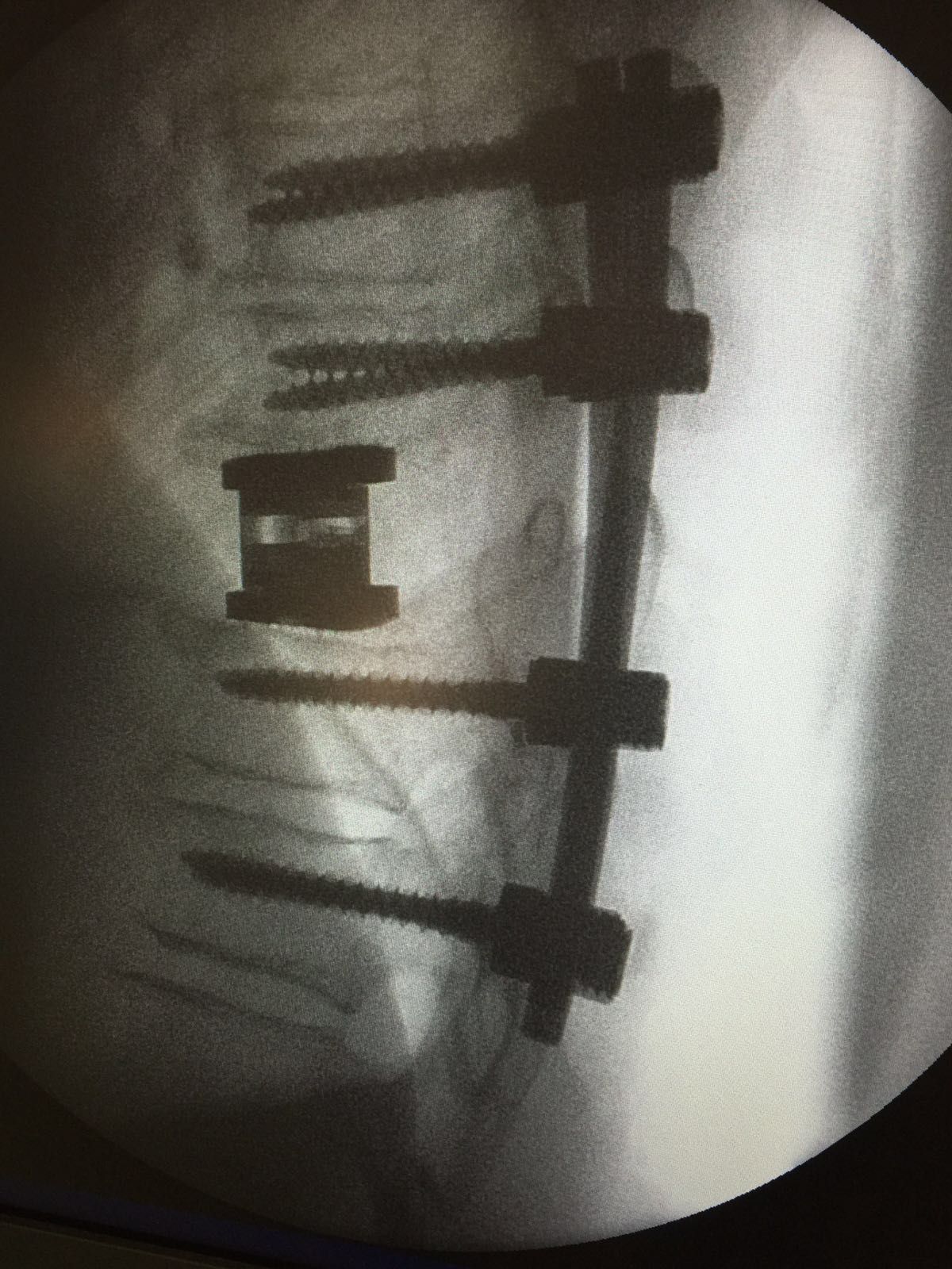 Juan Camilo Hernandez Acevedo-52