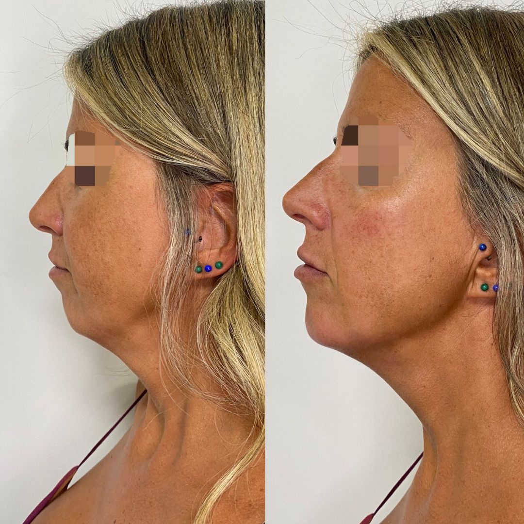 Illiana Cabrera Ortiz-3