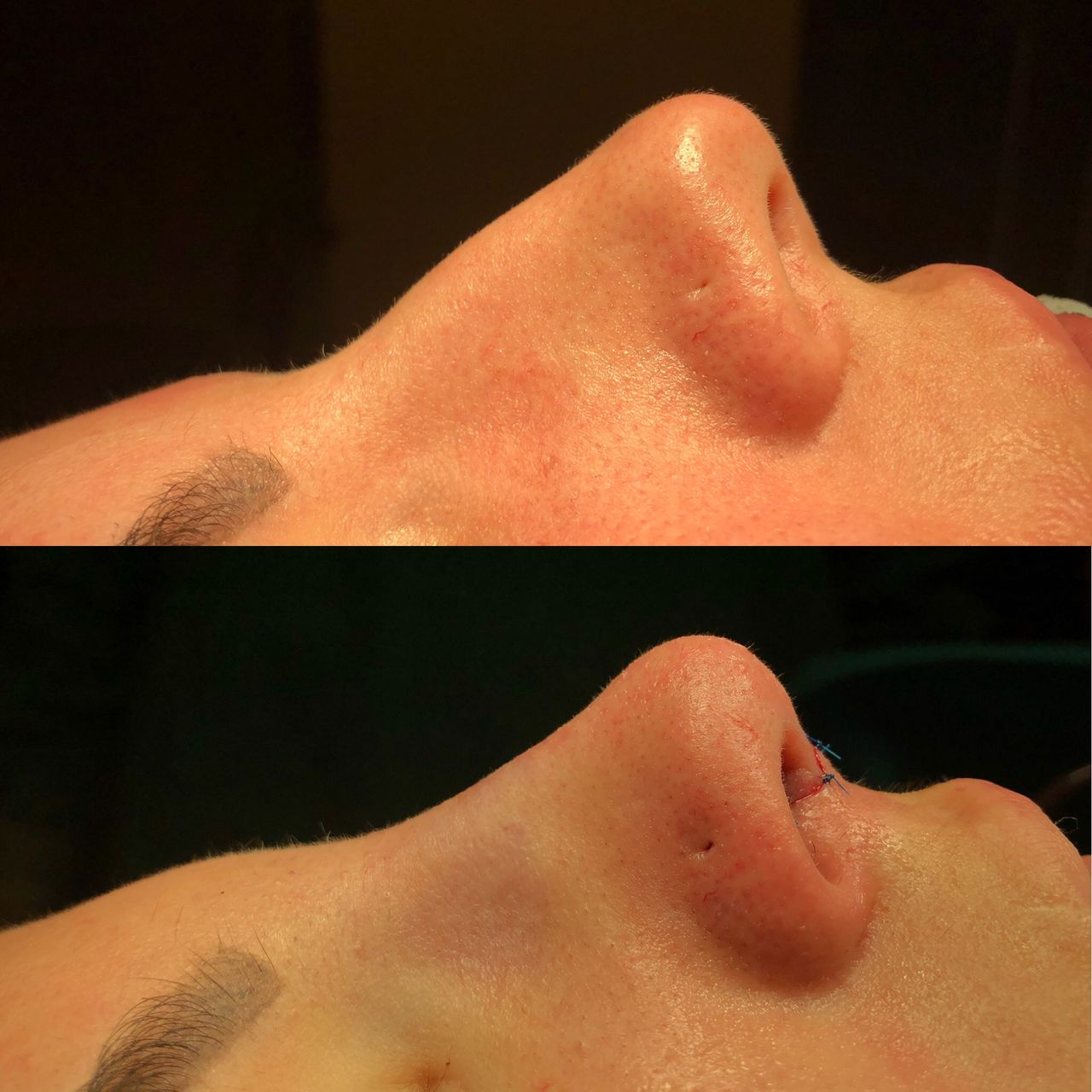 Alberto Candau Álvarez-27