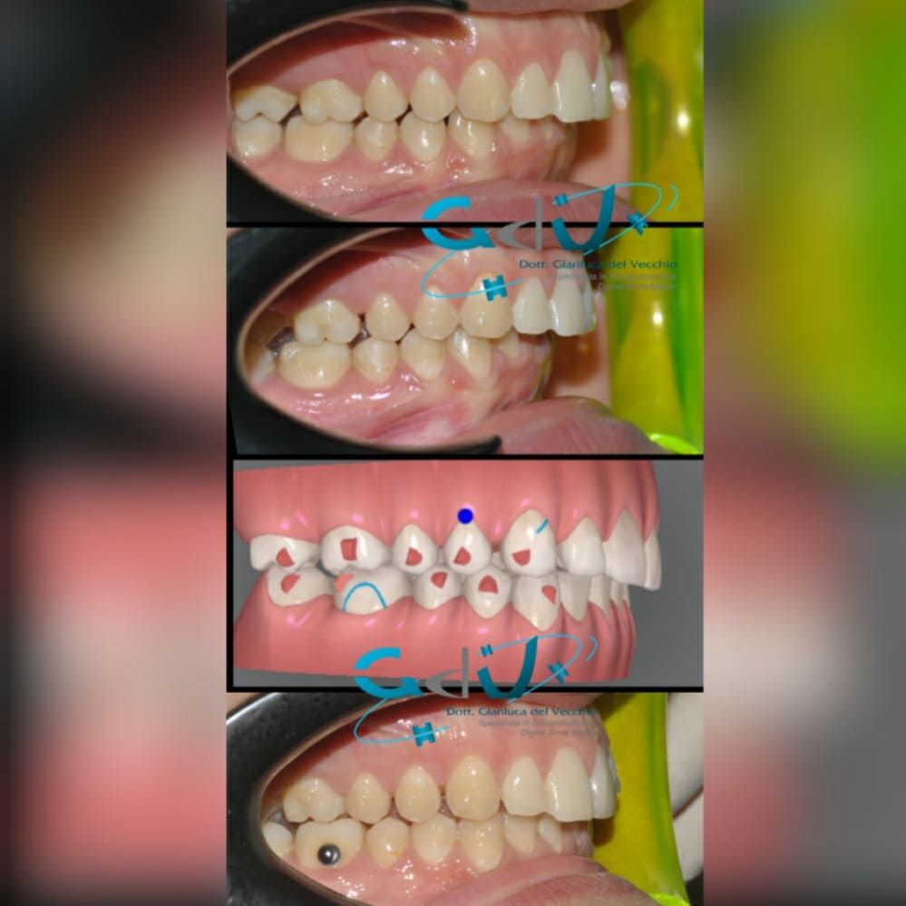 Gianluca Del Vecchio-130