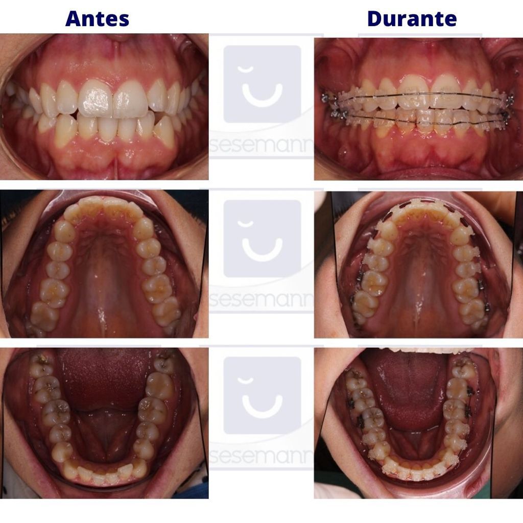 Paula Cano Carrillo-105