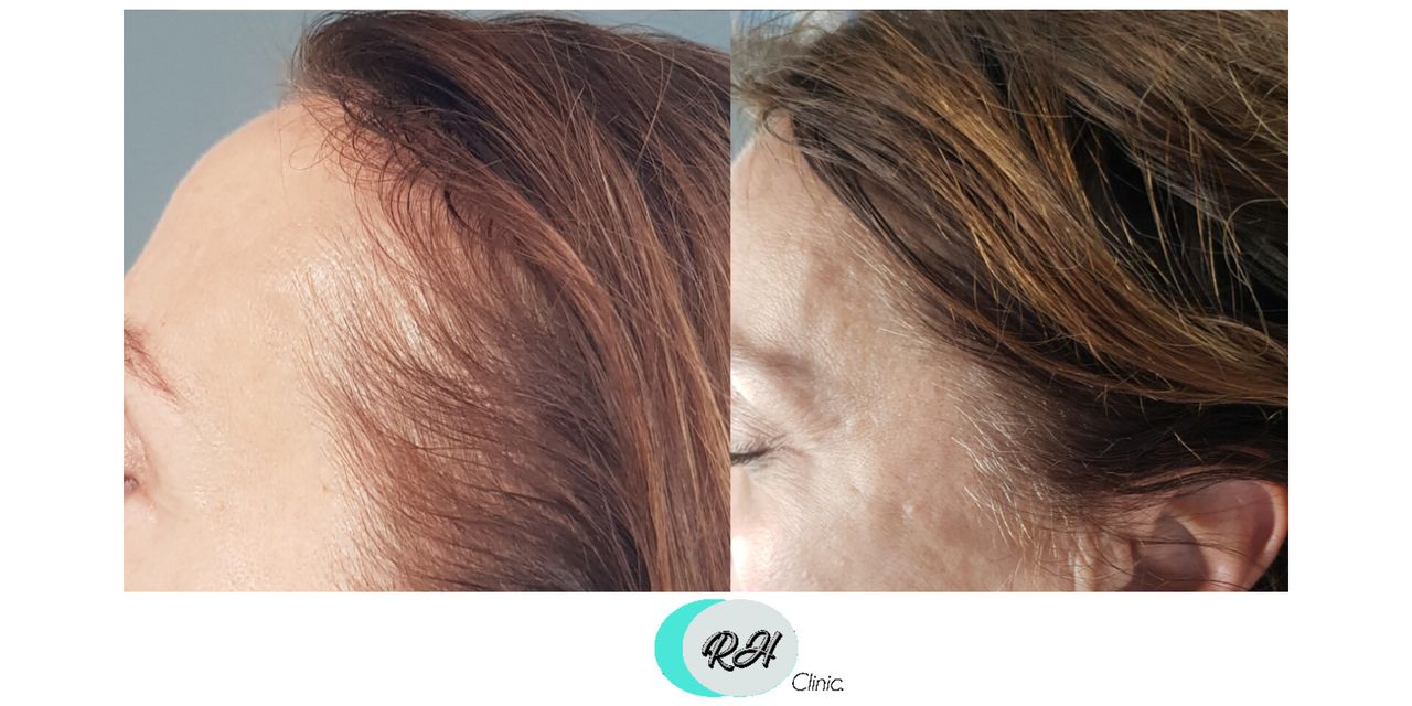 Rosalba Herrero Zerpa-623