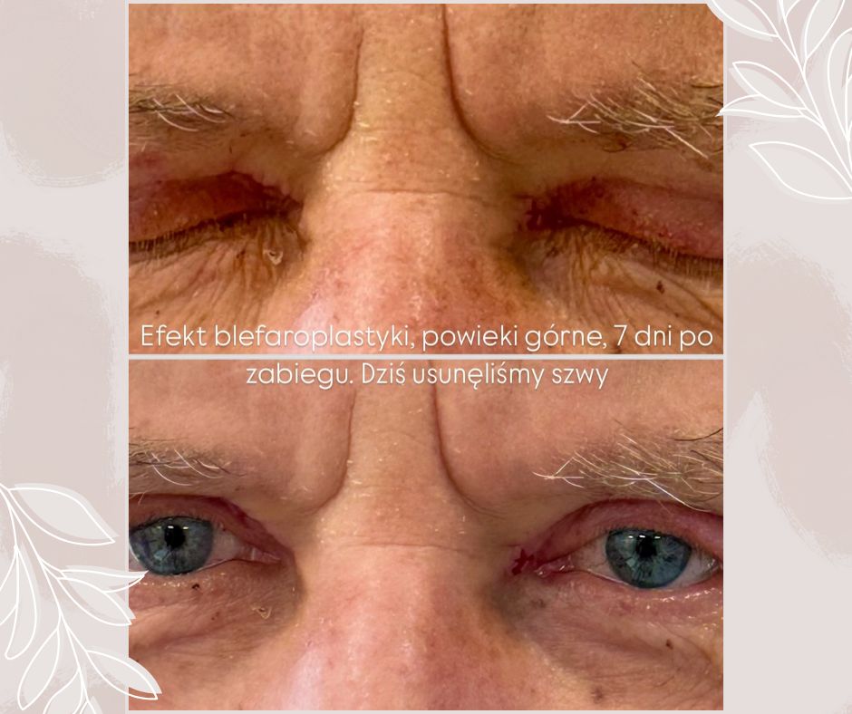 Piotr Florczuk-Dąbek-4