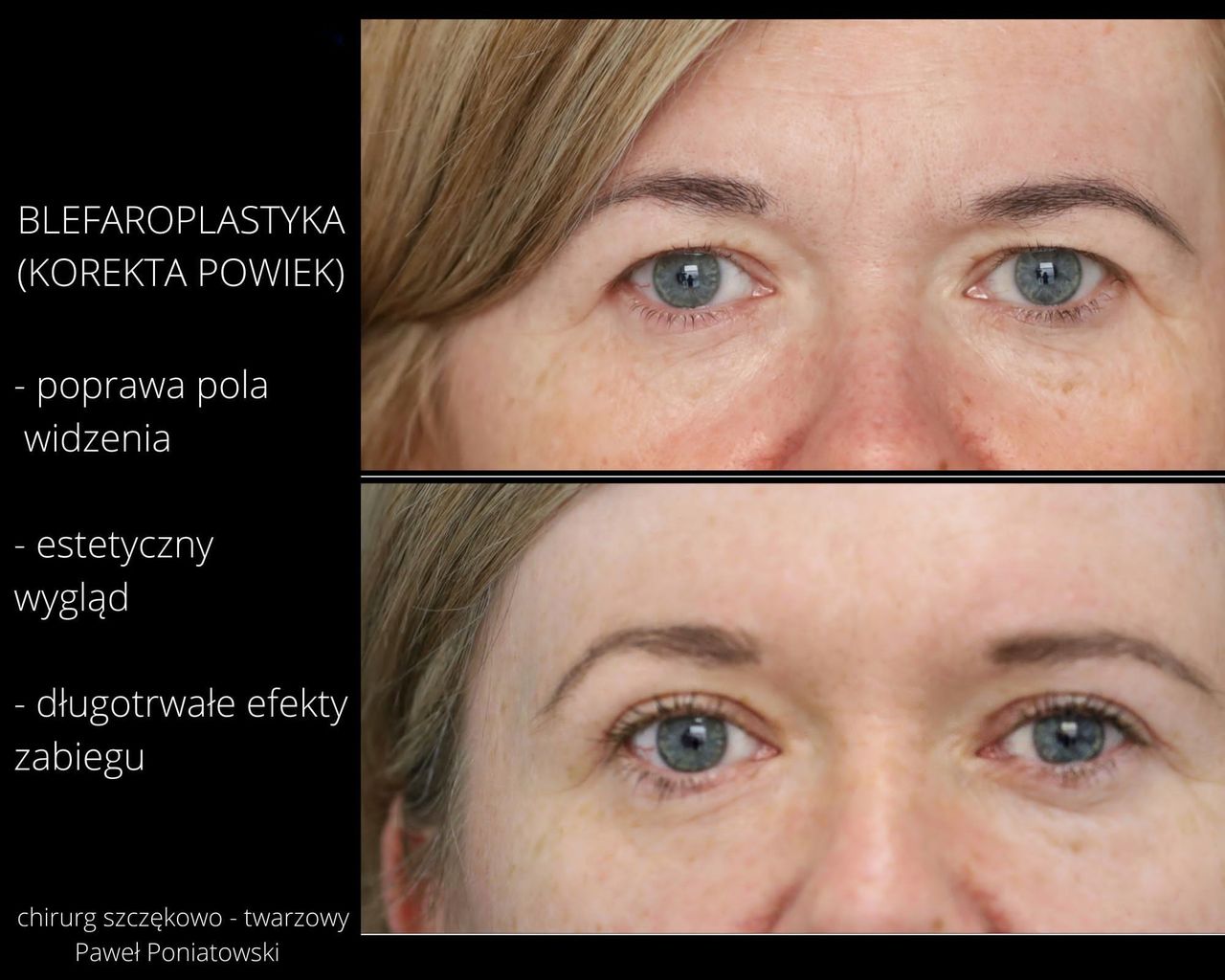 Paweł Poniatowski-9