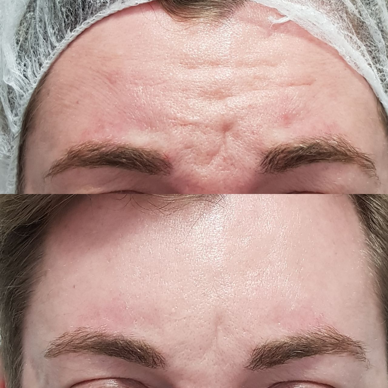 Rosalba Herrero Zerpa-299