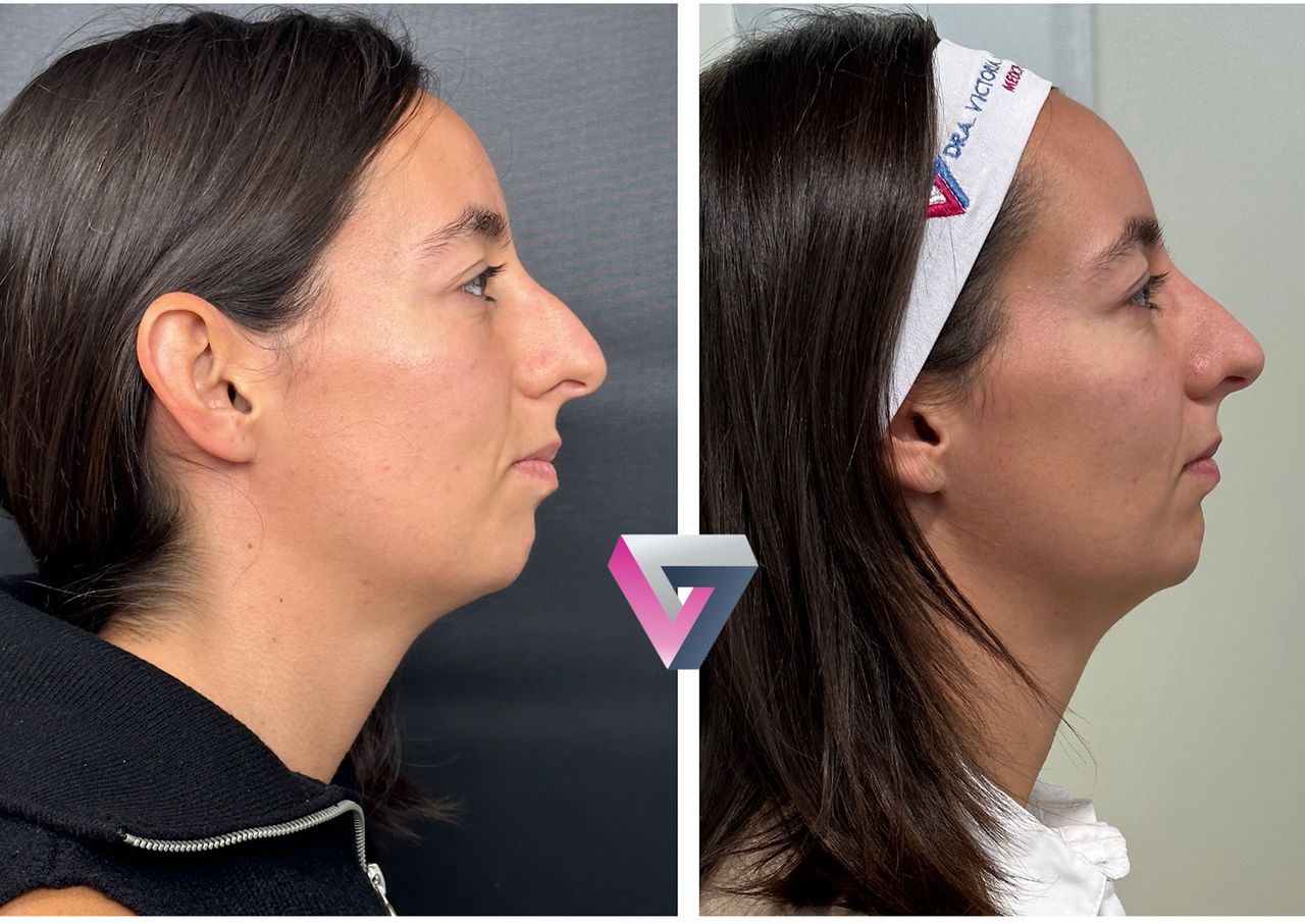 Victoria Trasmonte-93