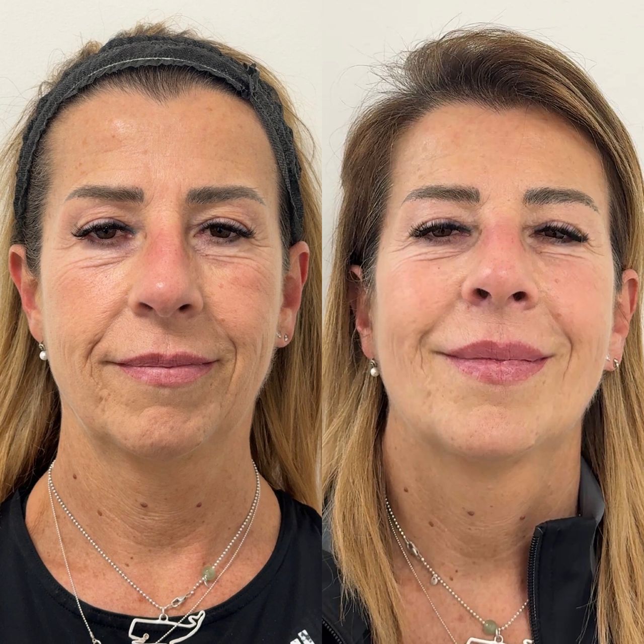 Loredana Mone-30
