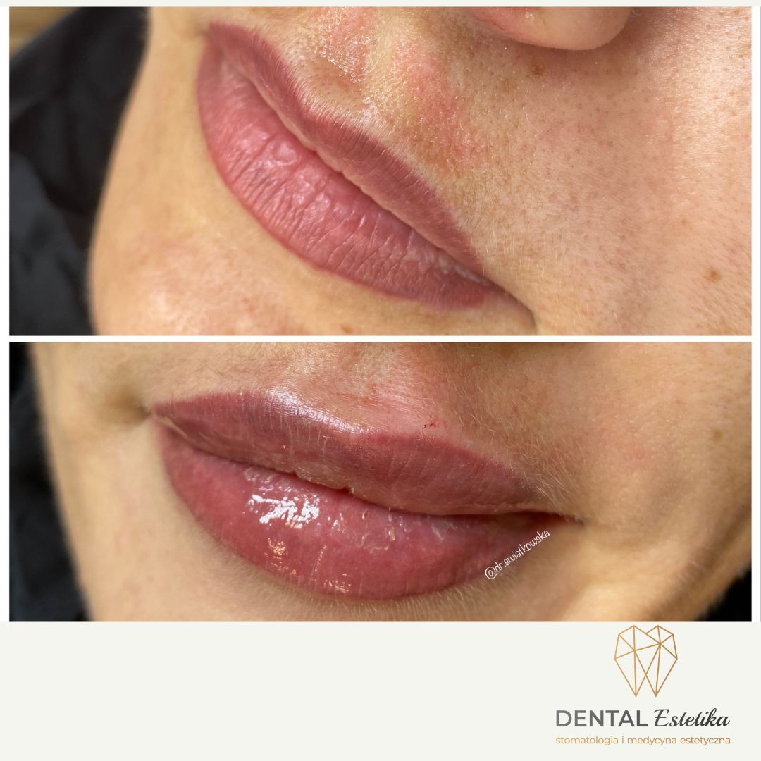 Angelika Świątkowska-45