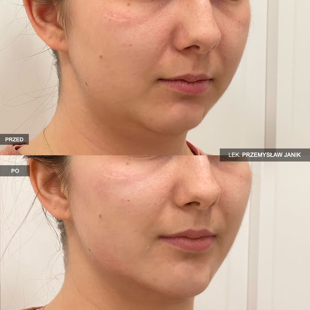 Przemysław Janik-41