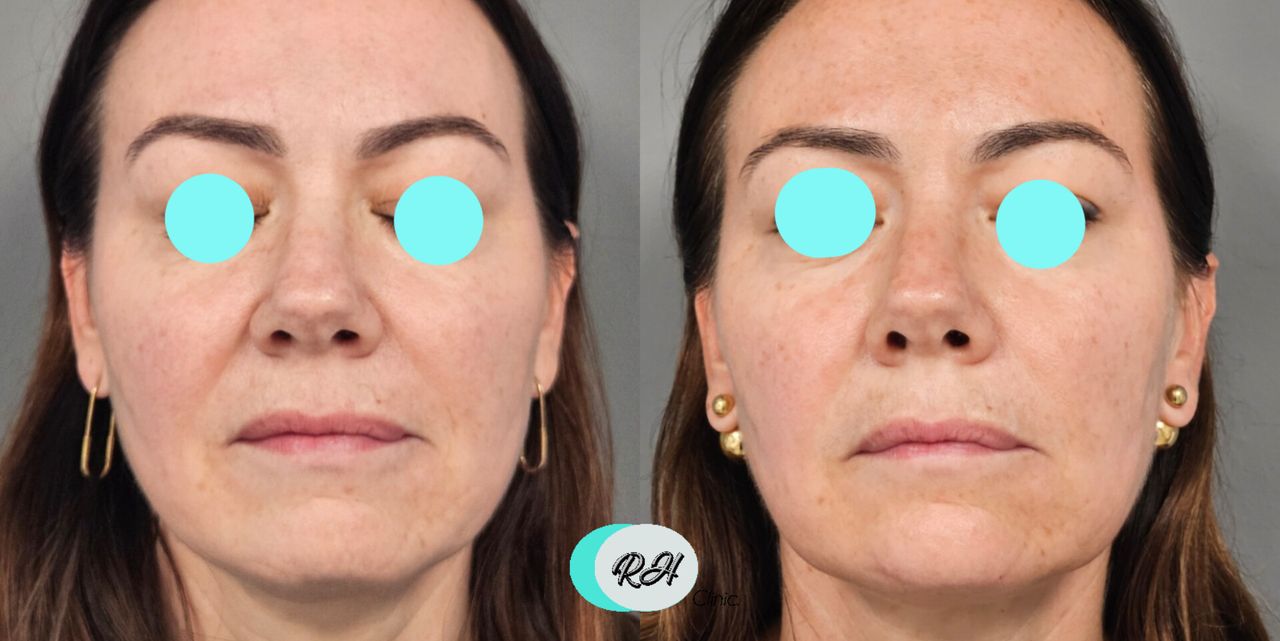 Rosalba Herrero Zerpa-614