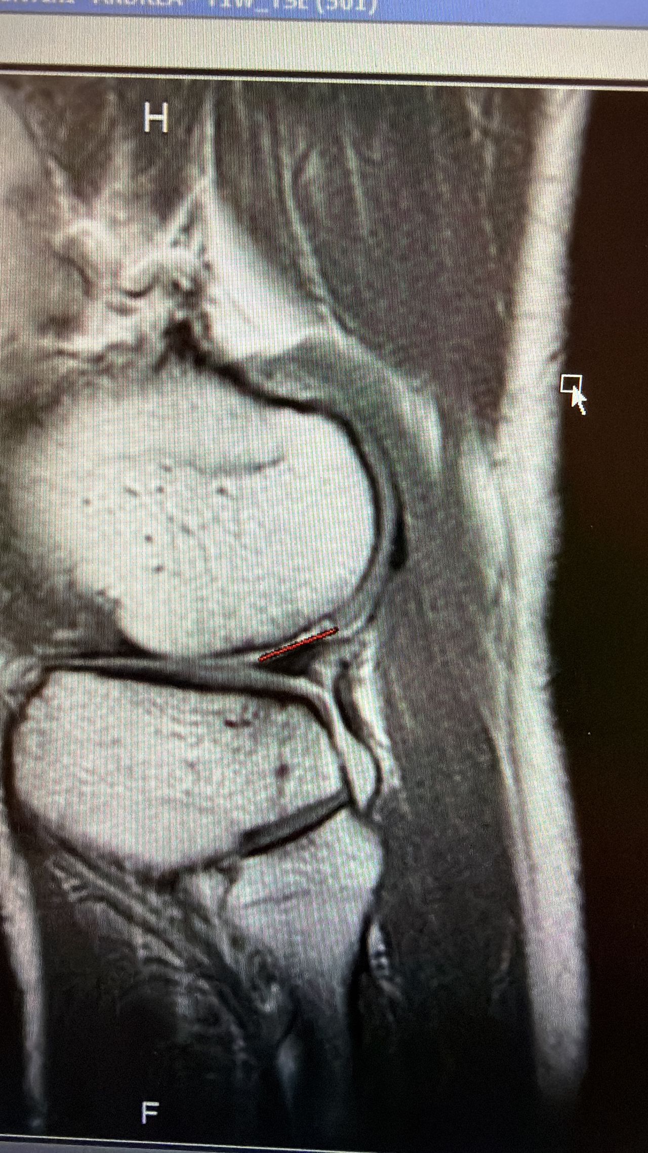 Filippo Della Martera-0