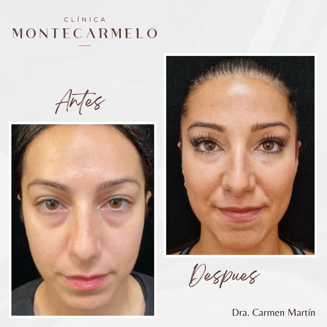 Carmen Martin Marcos-8