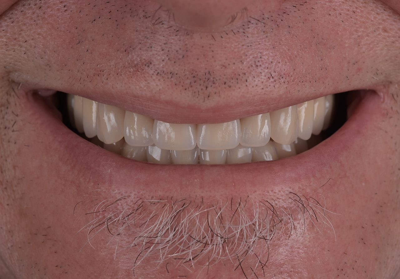 Riccardo Giardina-20