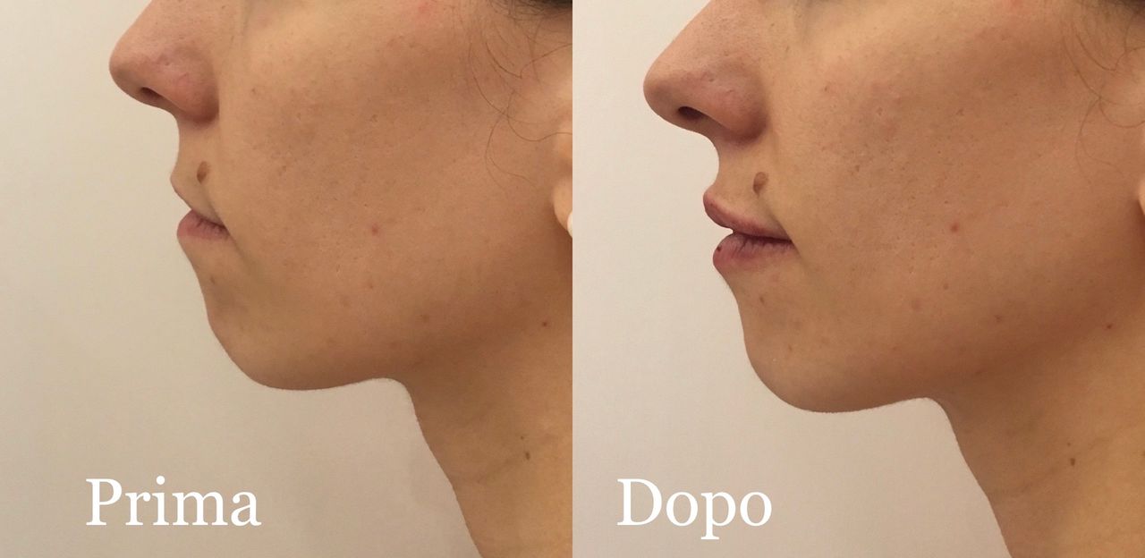 Elisabetta Fabiani-37