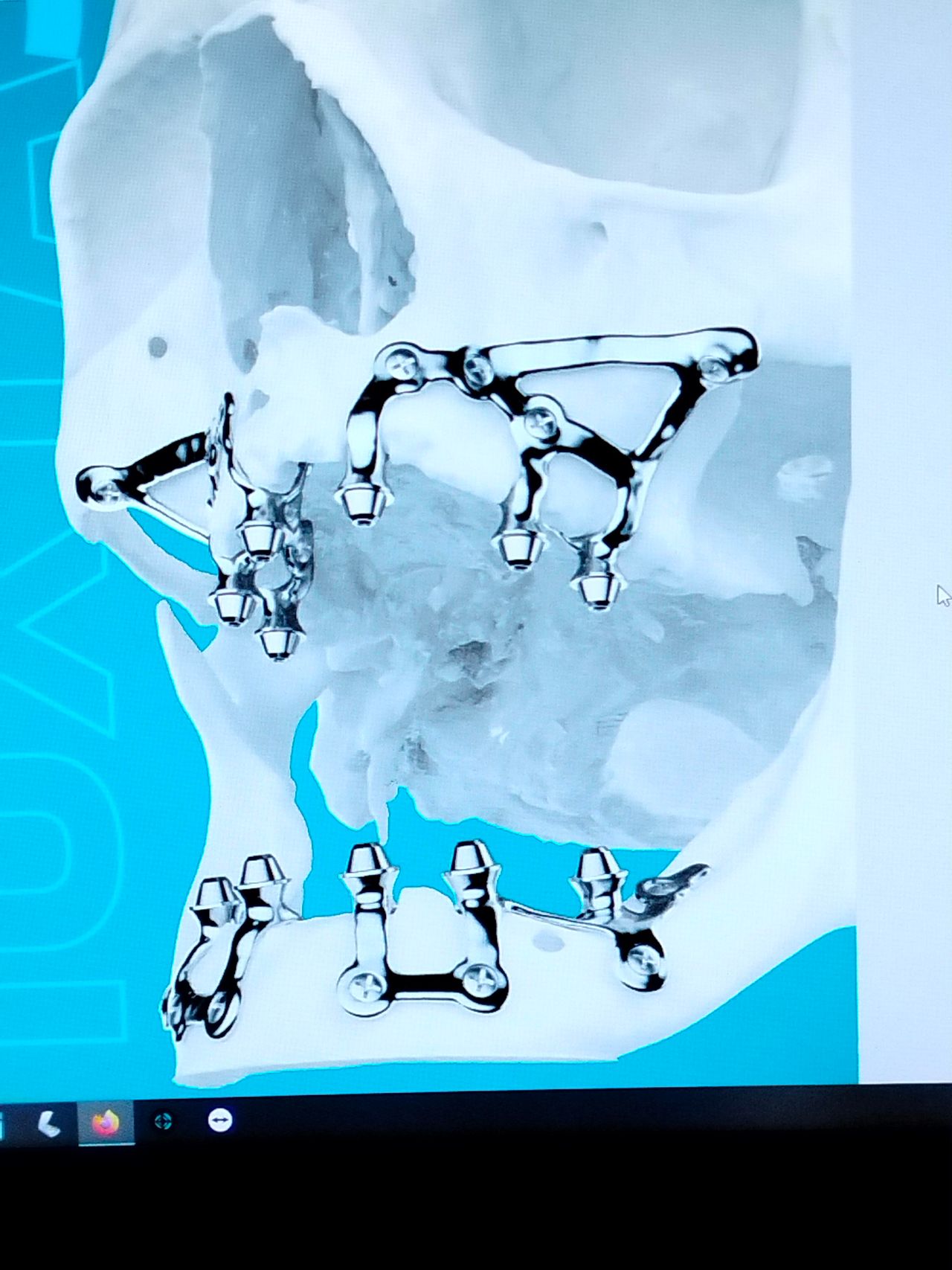 Marco Della Rovere-6