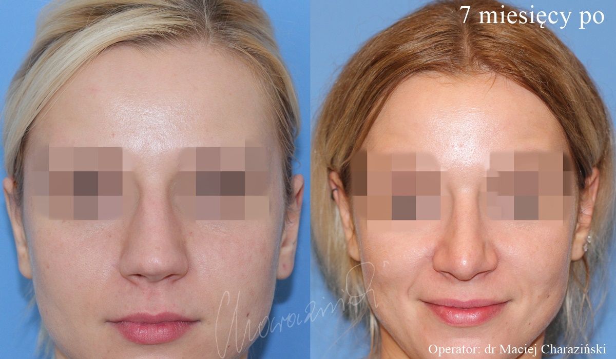 Maciej Charaziński-32