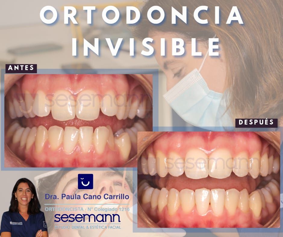 Paula Cano Carrillo-6