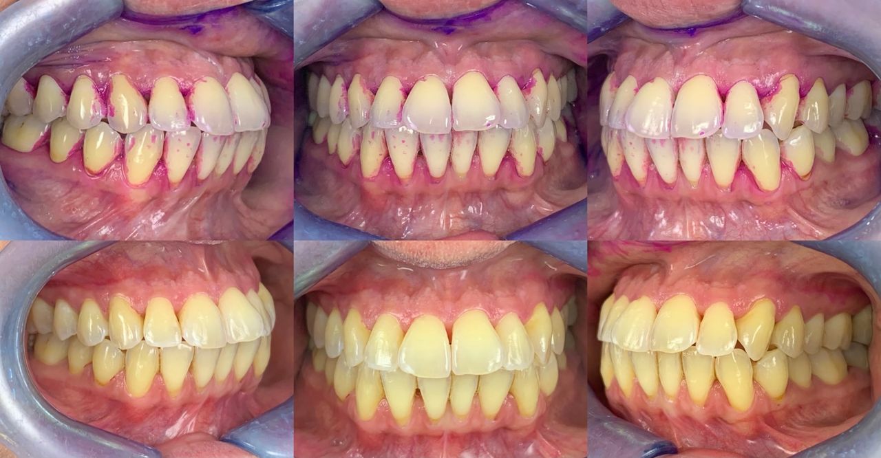 Gianluigi Bittante-88