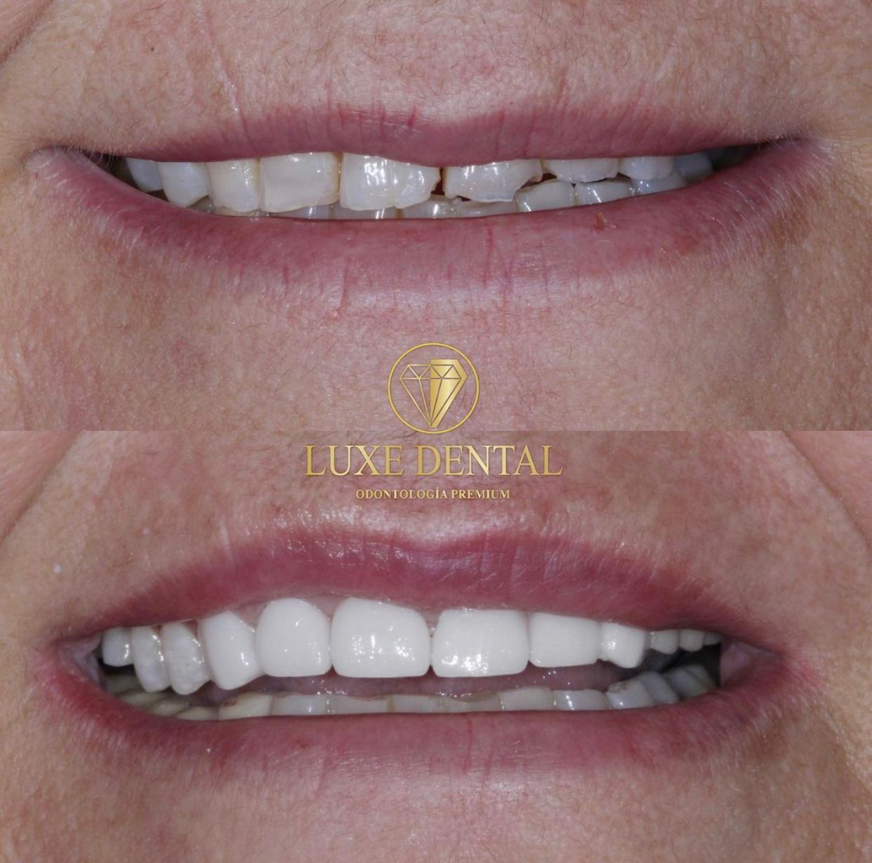 Ruben Patier Martin-6