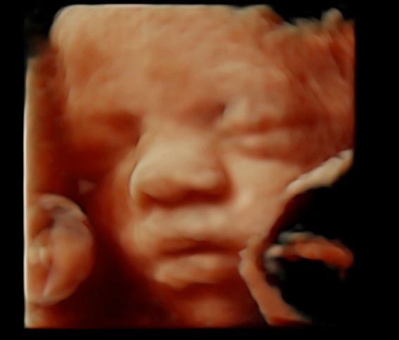 Tommaso Incandela-47