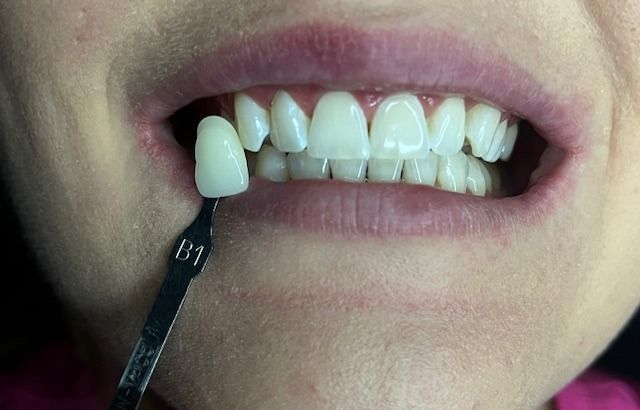 Karolina Rostkowska-7