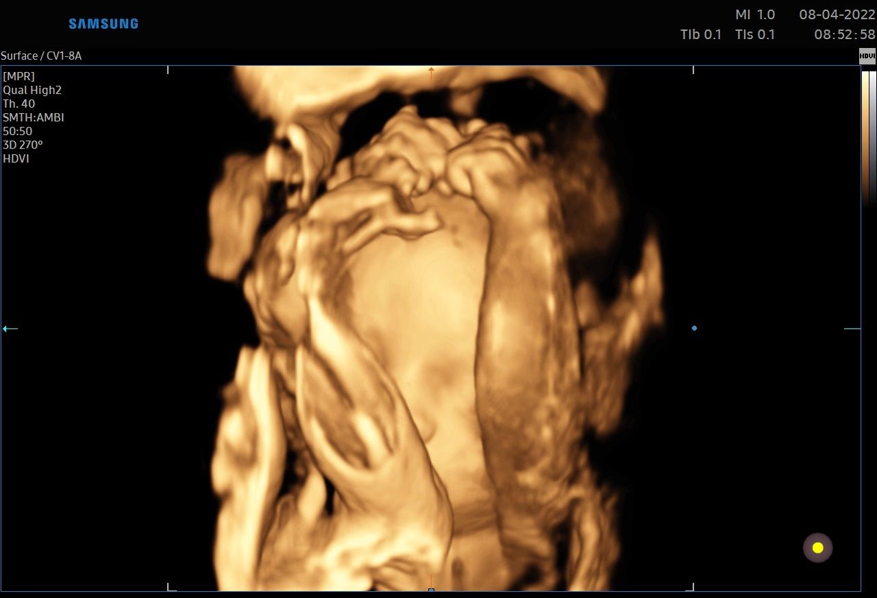 Valentina Conserva-11