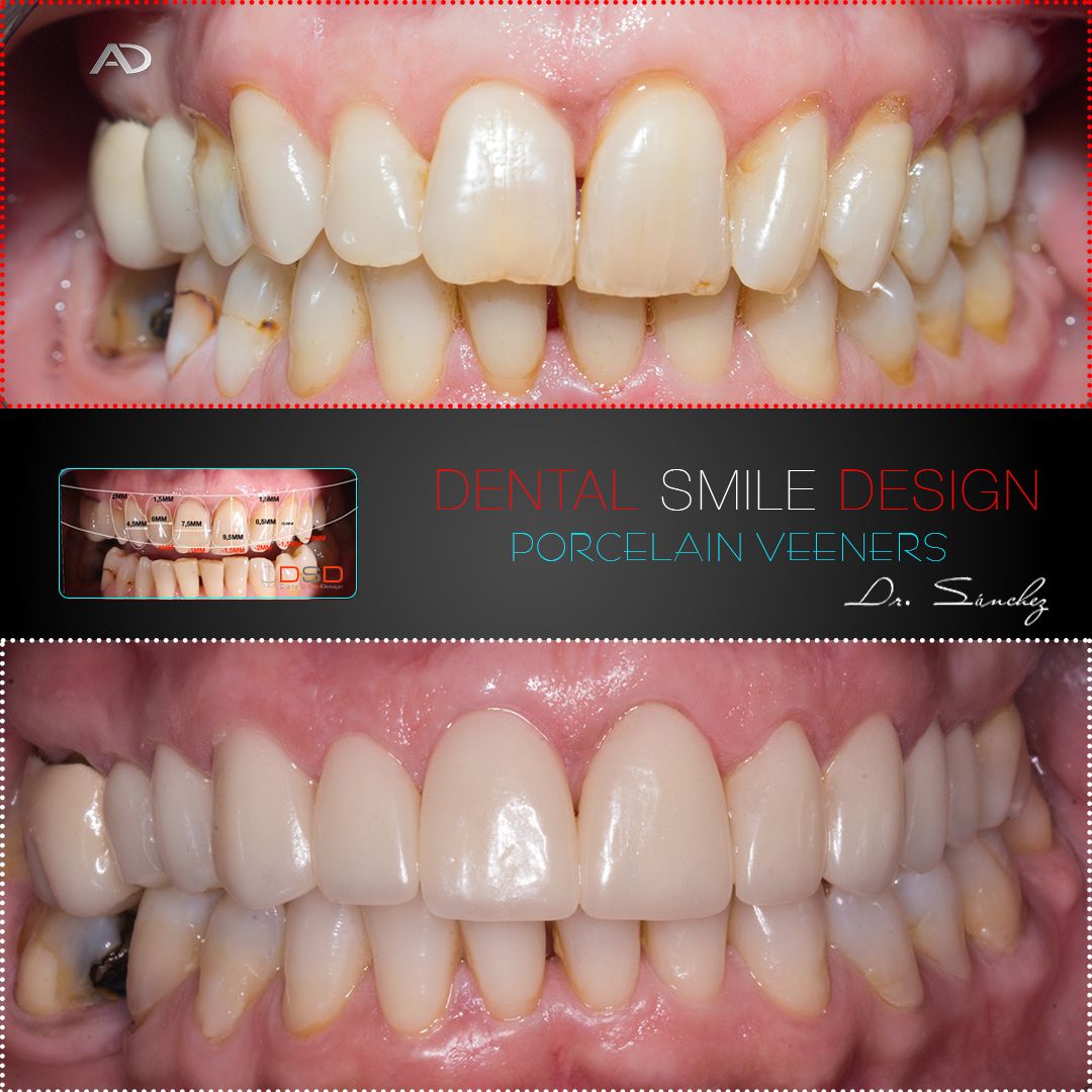 Juan Carlos Sánchez Pérez-16