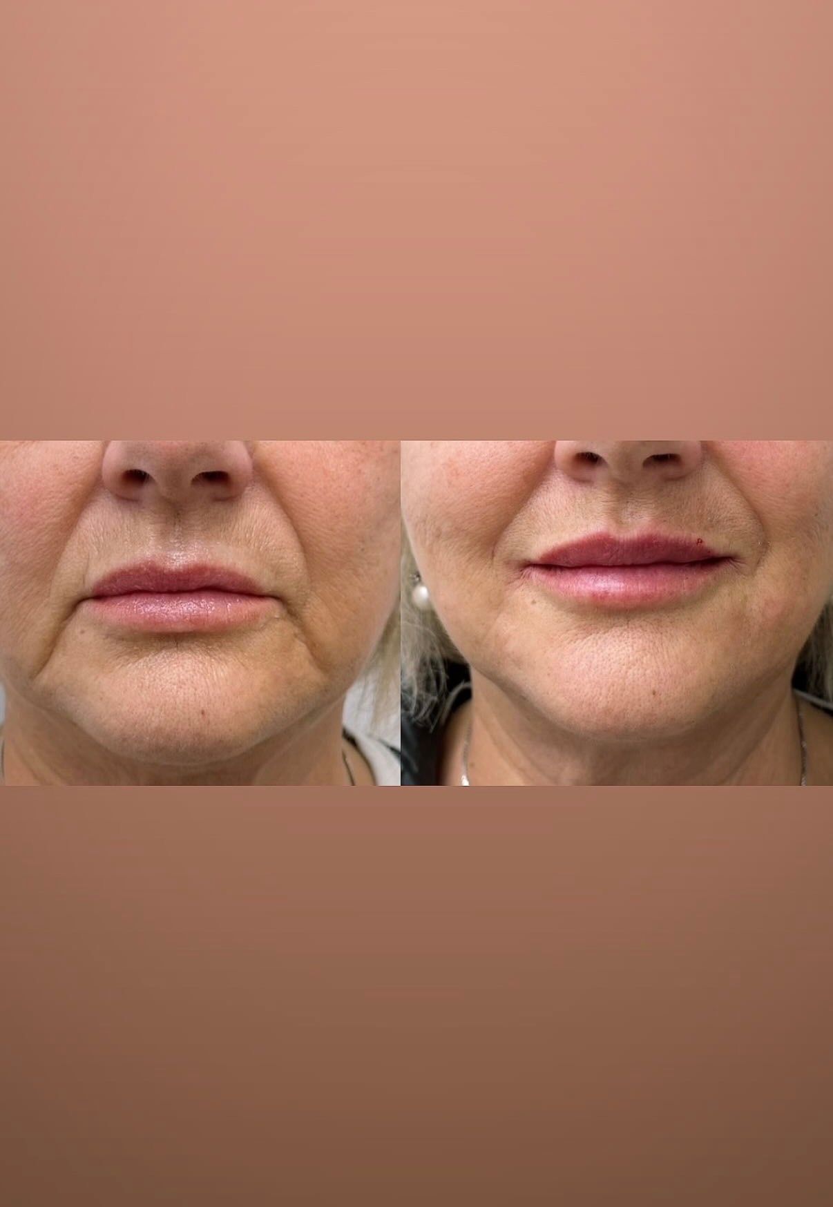 Maria Carmen Stabile-56