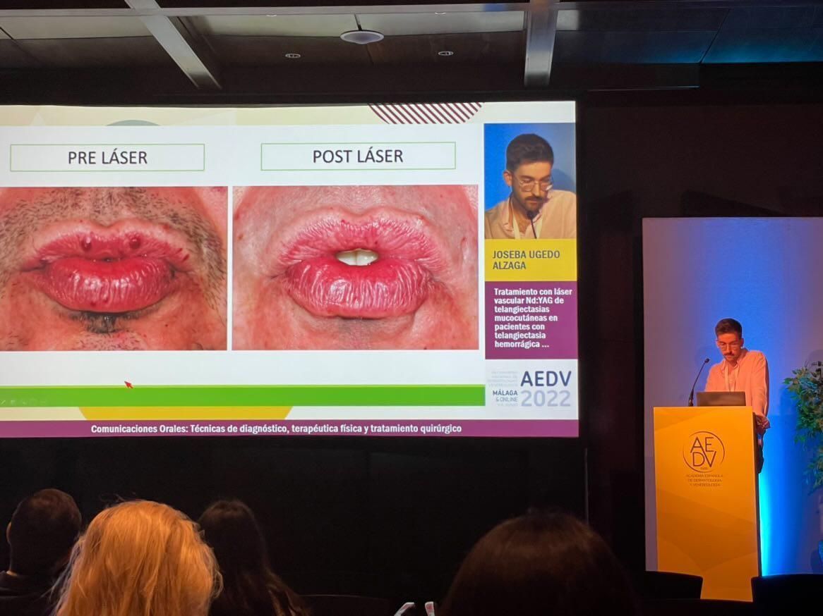 Joseba Ugedo Alzaga-1