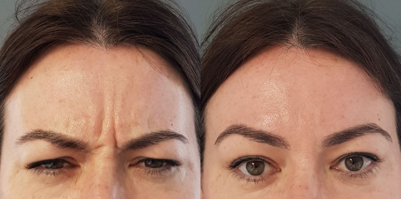 Rosalba Herrero Zerpa-494