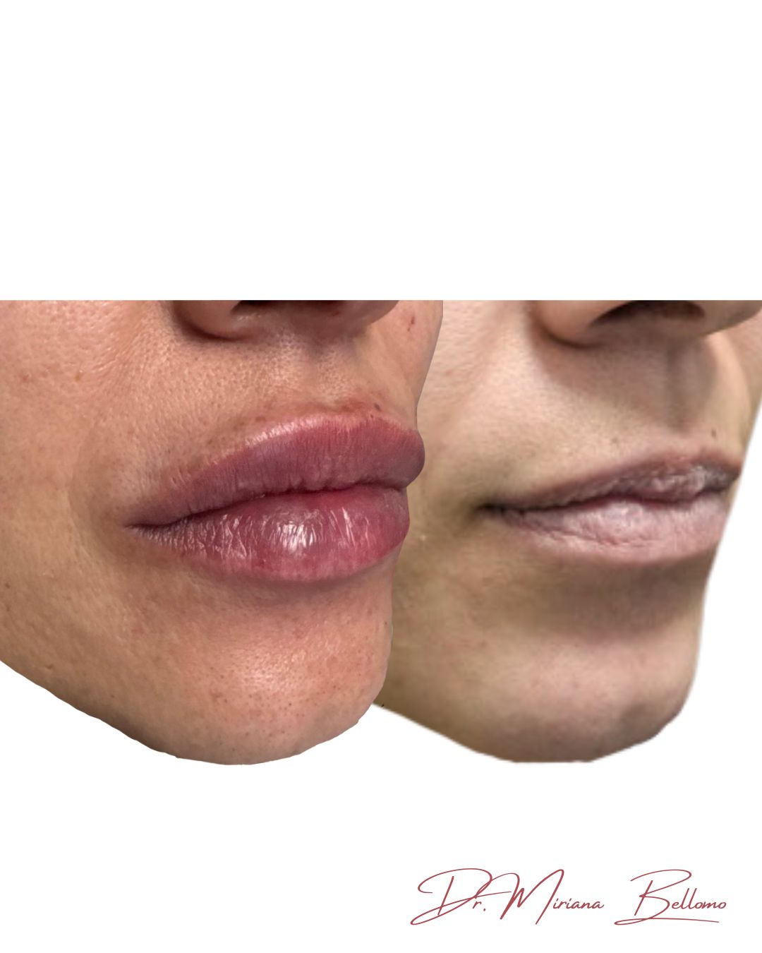Miriana Bellomo-2
