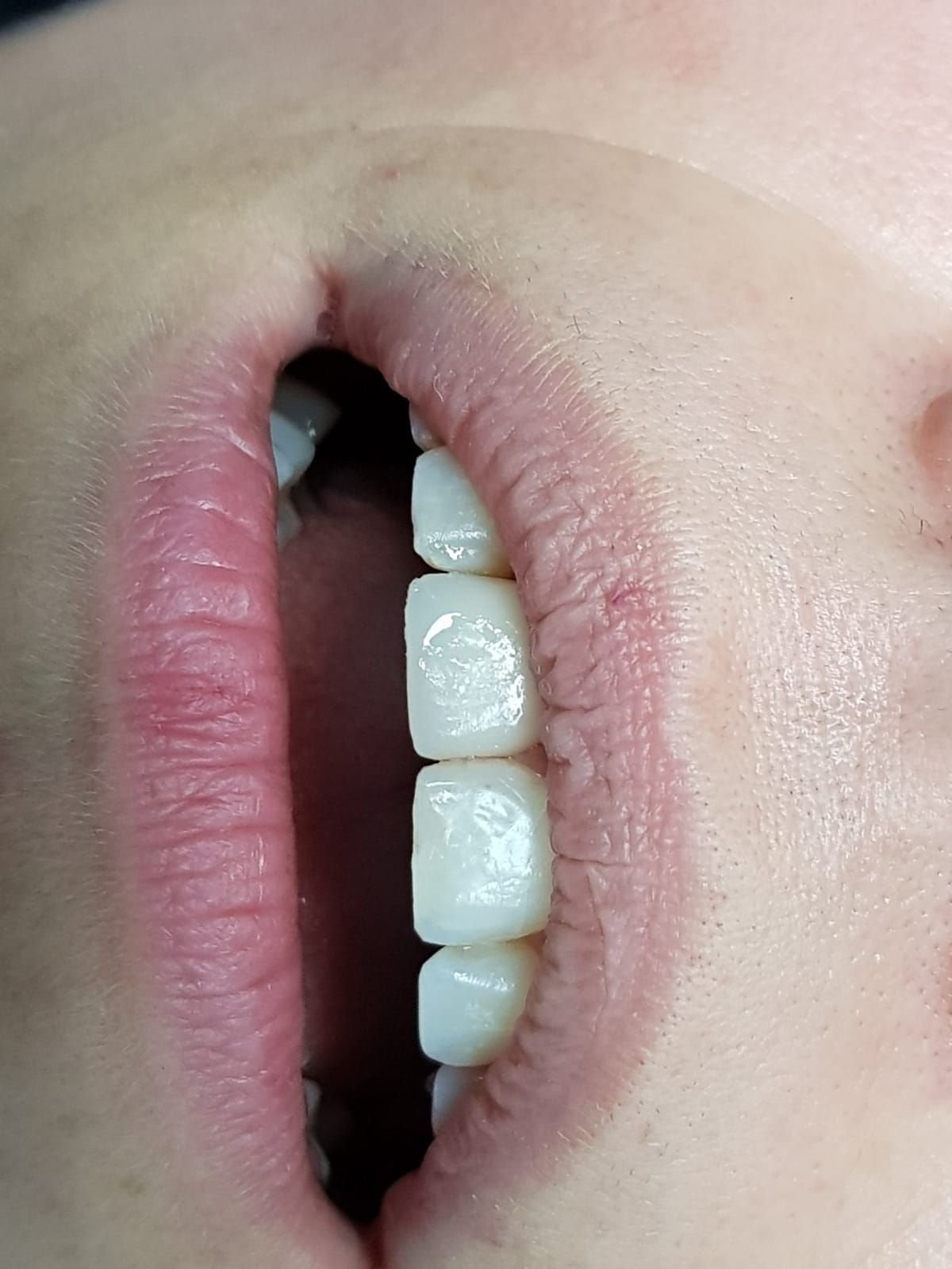 Stefano De Simone-54