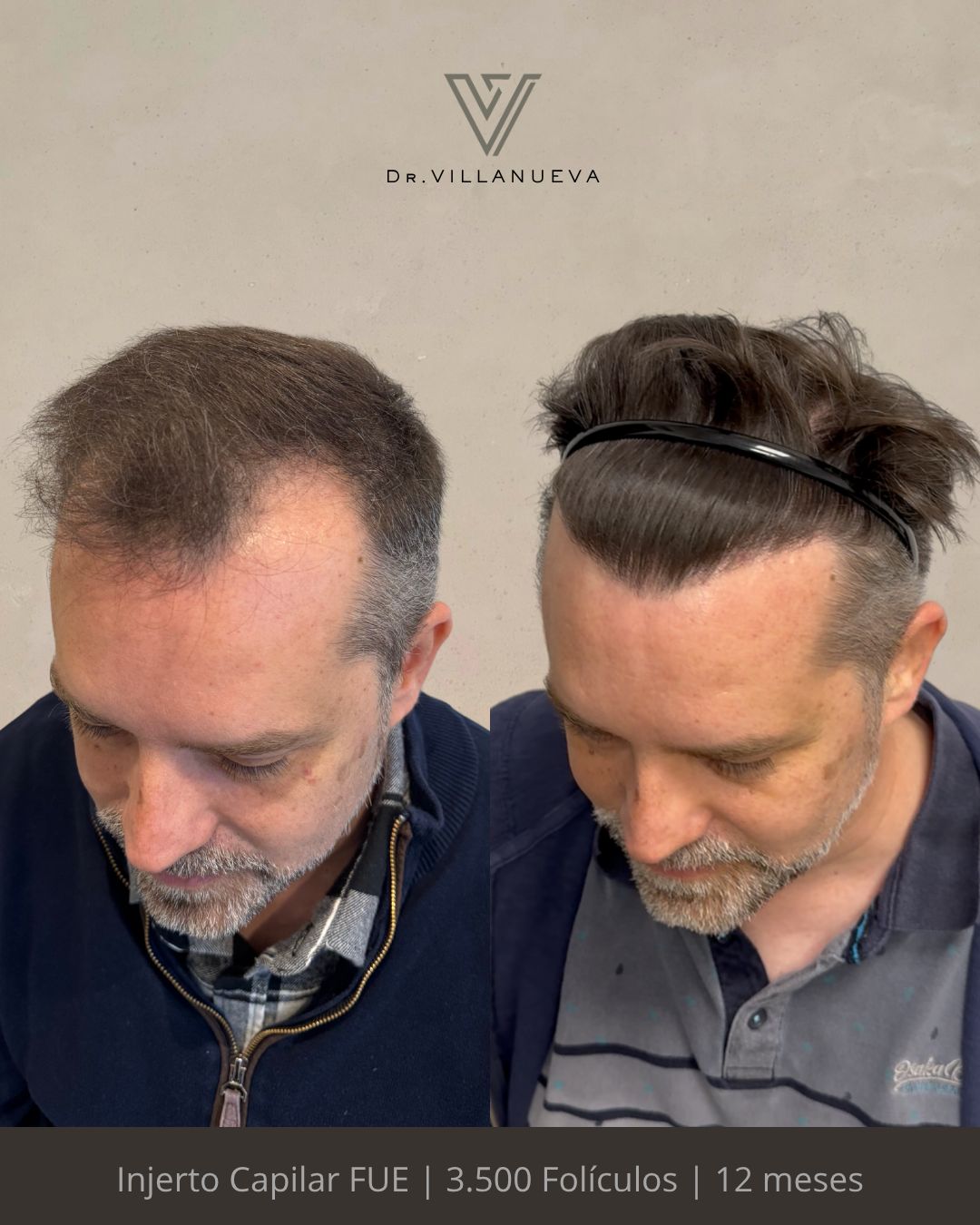 Alfredo Villanueva-5