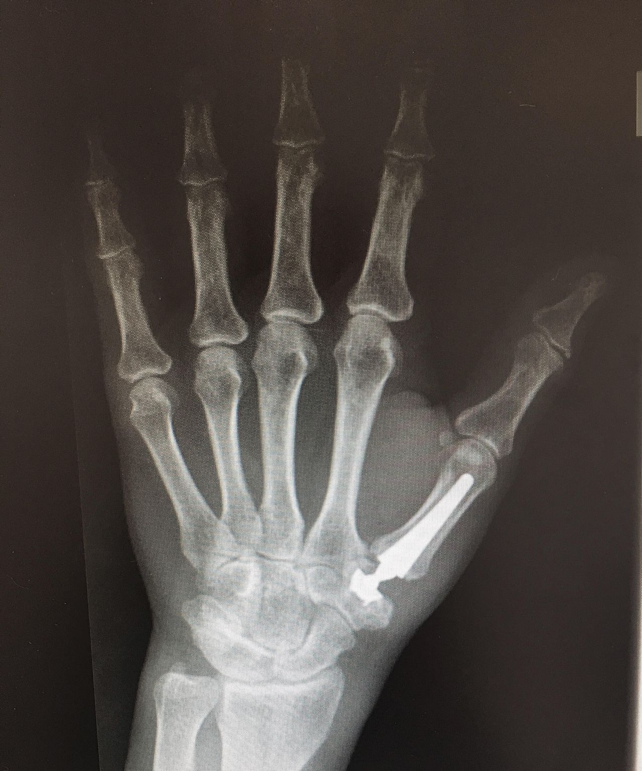 Gonzalo Menéndez Viñuela-4