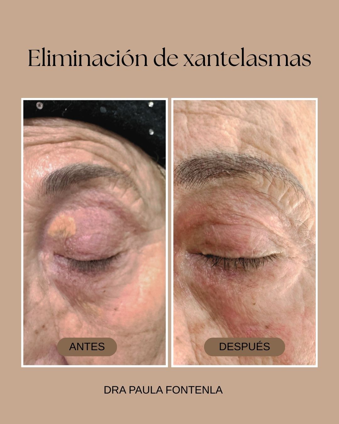 Paula Fontenla Seco-6