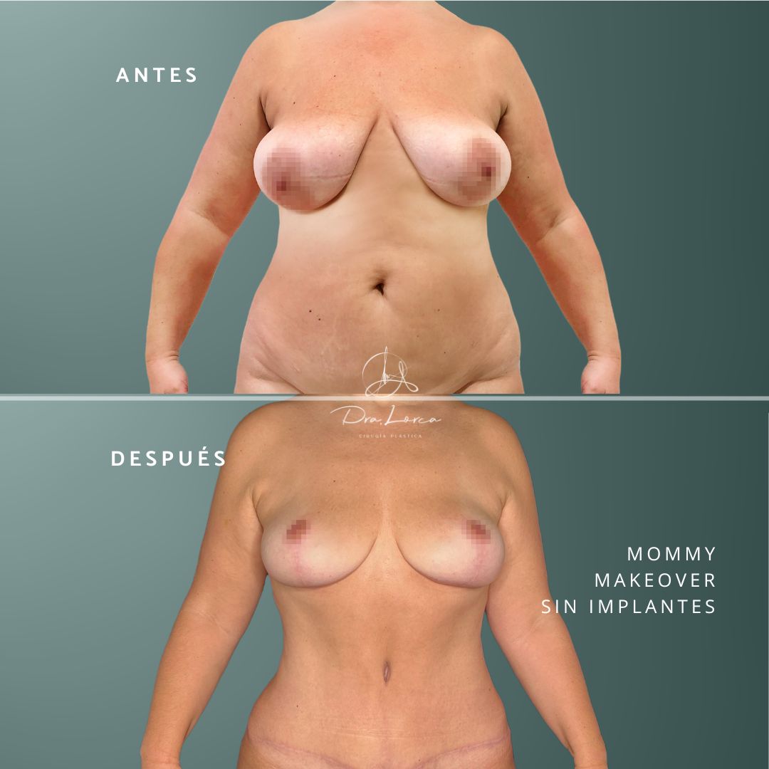 Concepción Lorca García-6