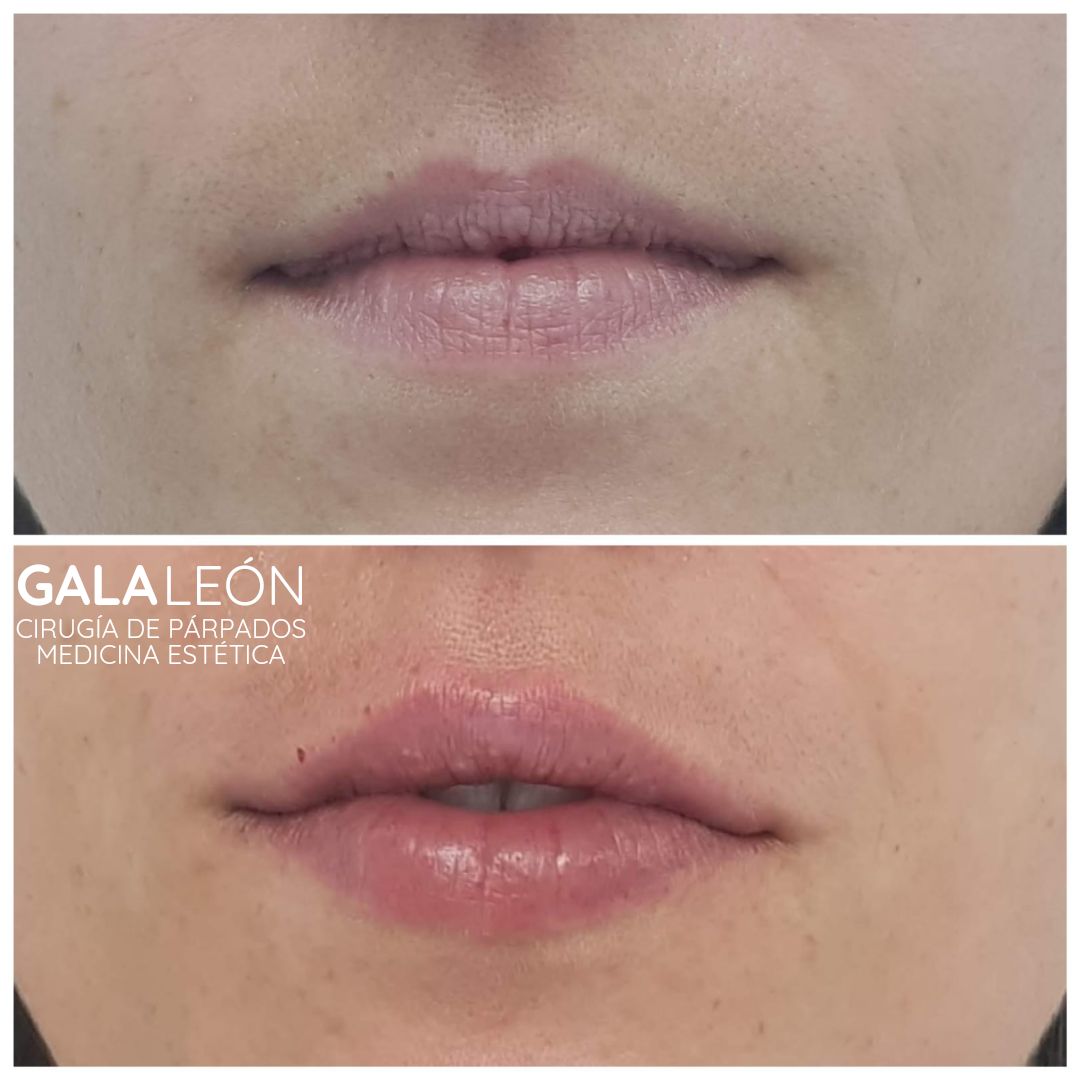 Gala P. Leon Salvatierra-30