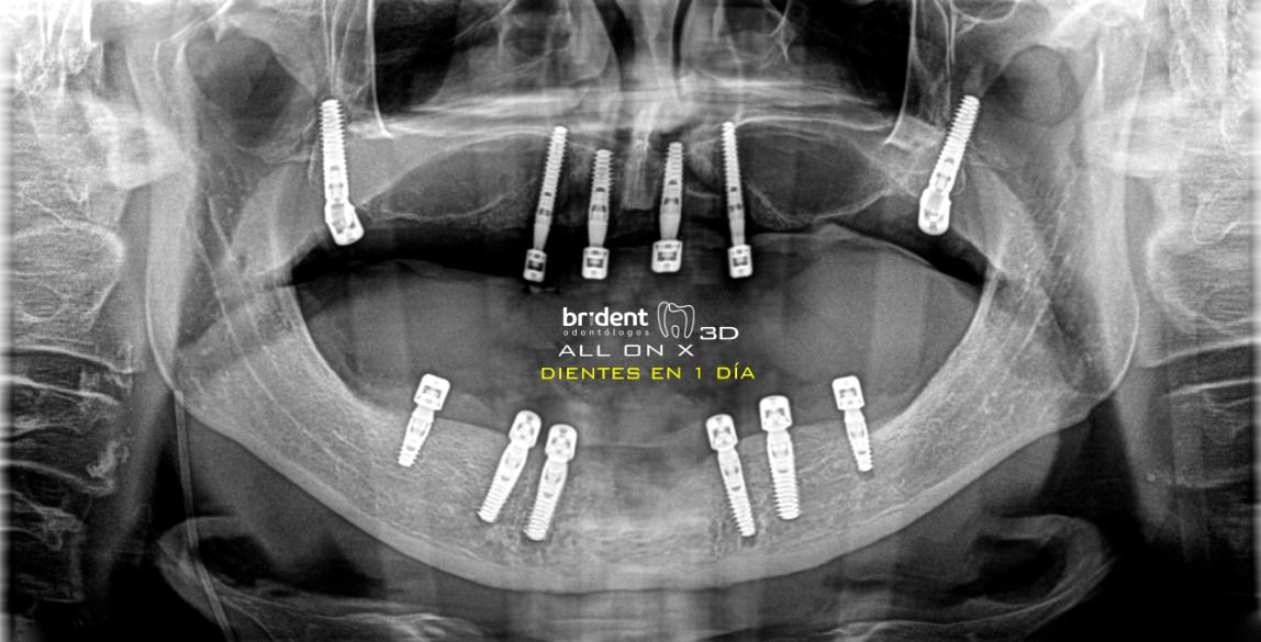 Guillermo Moreno Masiá-42