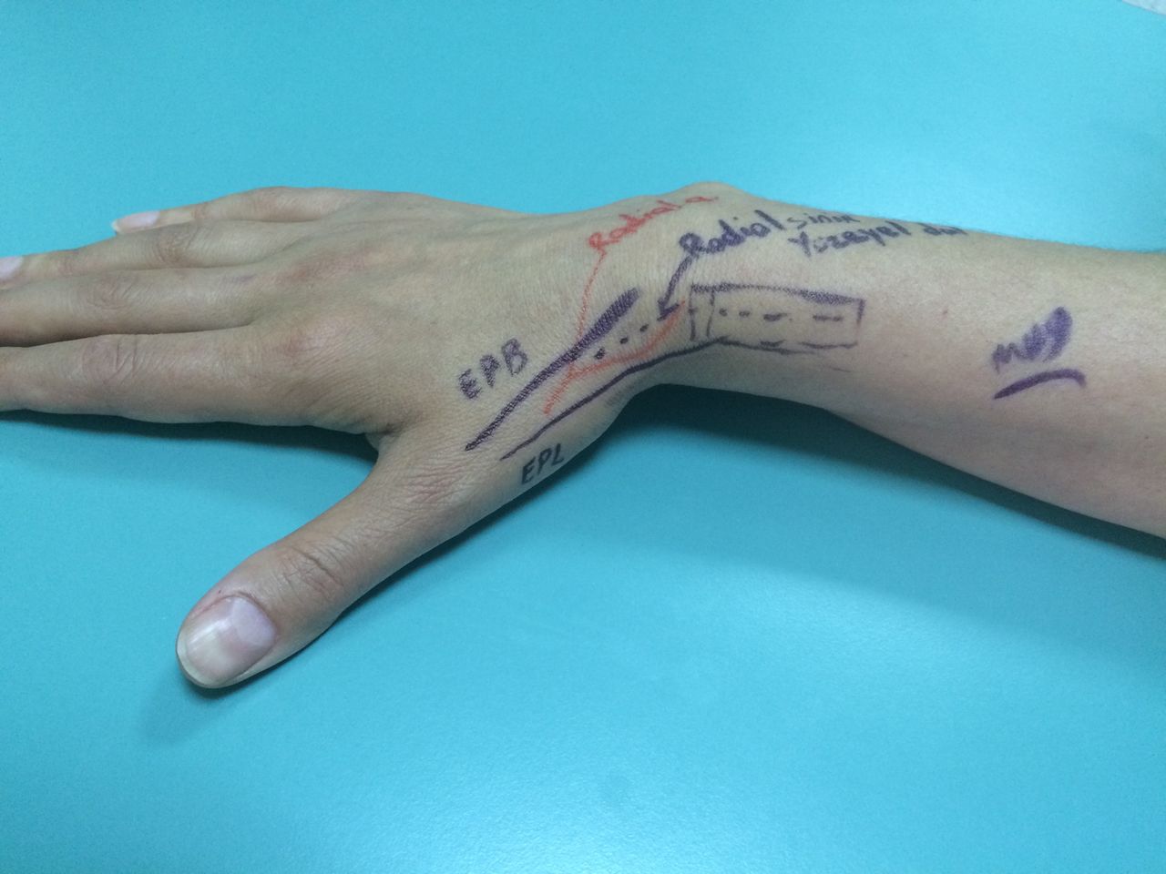 Mehmet Hakan Yılmaz-10