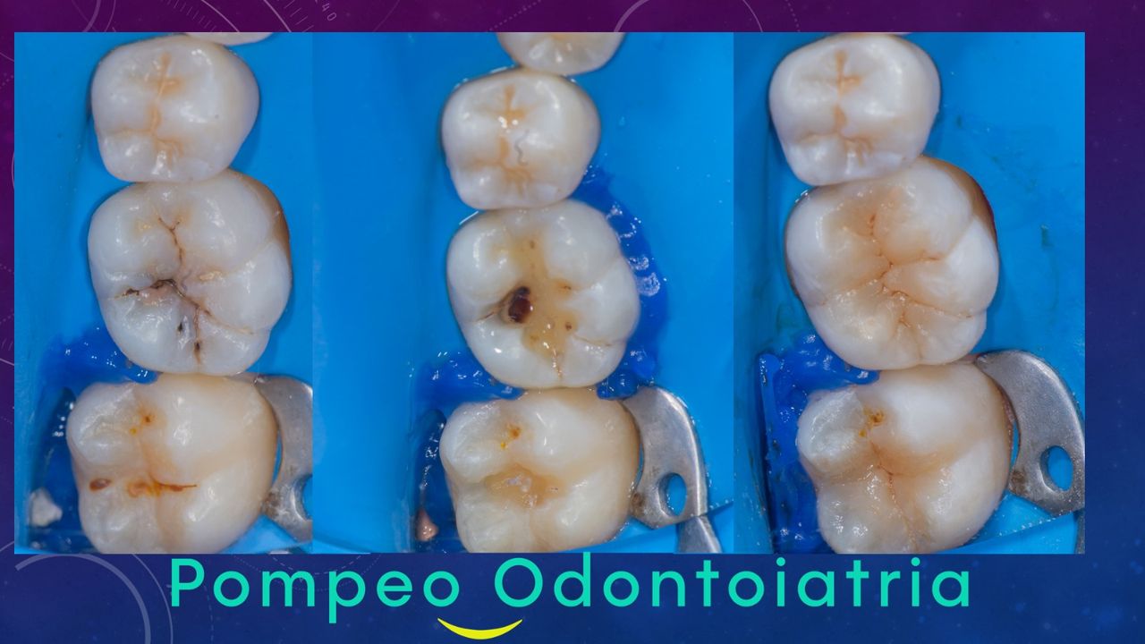 Enrico Maria Pompeo-6