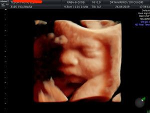 José Antonio Navarro Repiso-3